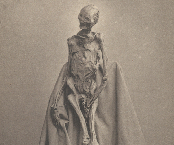 The Rendswühren Man